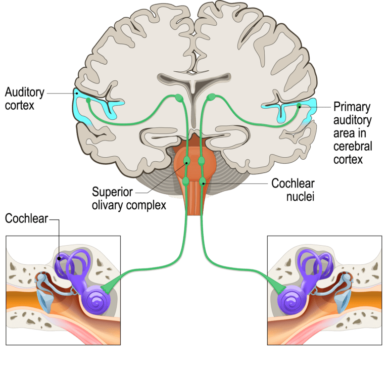 Learn About Hearing Loss | Hearing Clinic Group | Markham, Scarborough