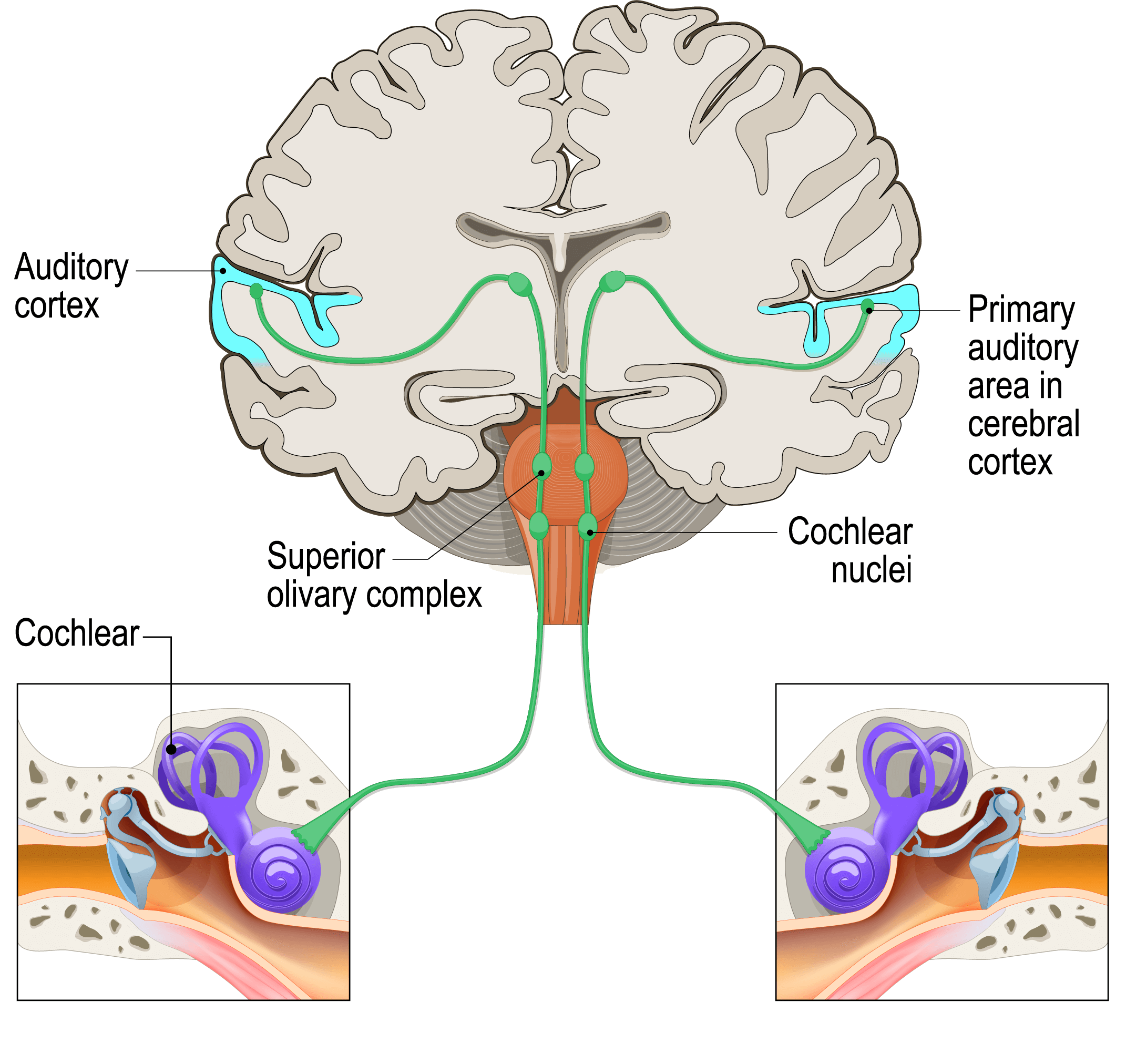 The Auditory Brain